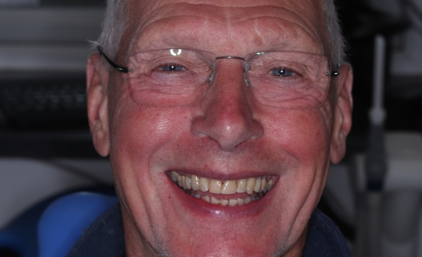After - Taylored Dental Care