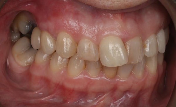 After - Taylored Dental Care