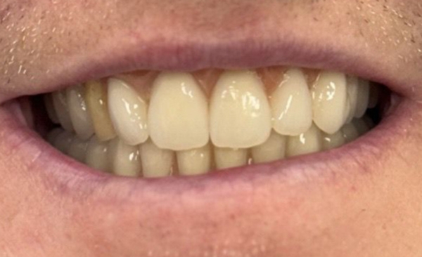 After - Taylored Dental Care