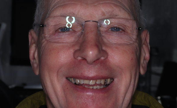 Before - Taylored Dental Care