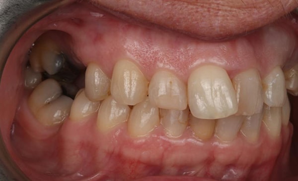 Before - Taylored Dental Care