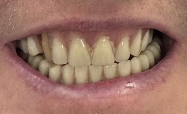 Before - Taylored Dental Care