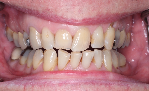 After - Taylored Dental Care