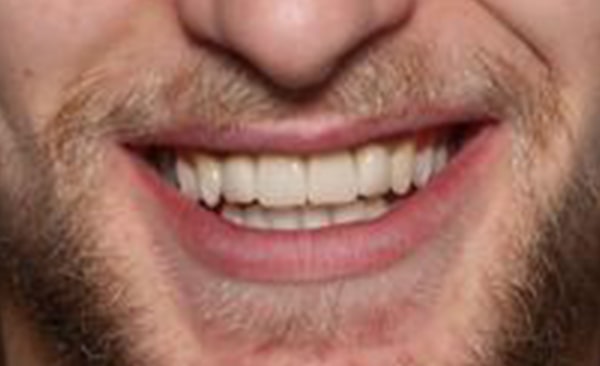 After - Taylored Dental Care