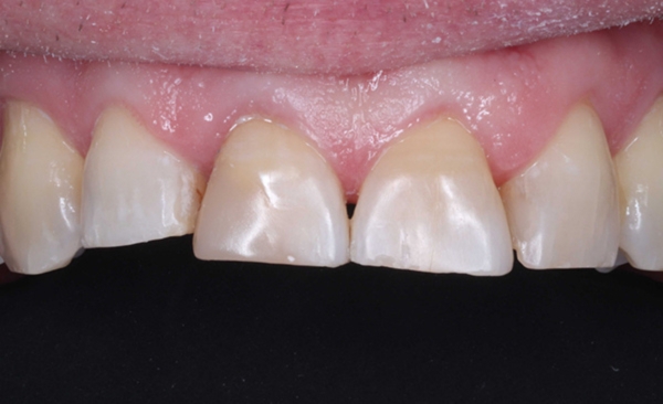 After - Taylored Dental Care