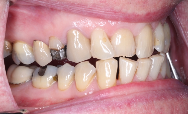 Before - Taylored Dental Care
