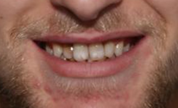 Before - Taylored Dental Care