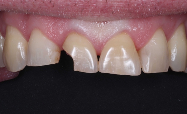 Before - Taylored Dental Care