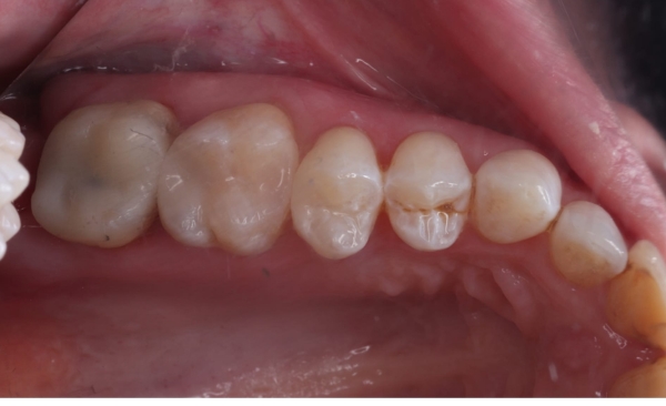 After - Taylored Dental Care