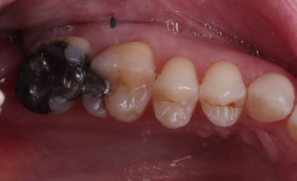 Before - Taylored Dental Care
