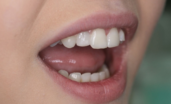 After - Taylored Dental Care