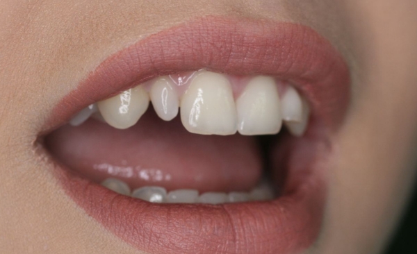 Before - Taylored Dental Care