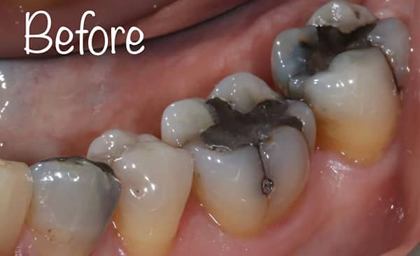 Before - Taylored Dental Care