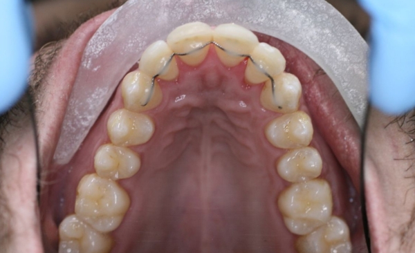 After - Taylored Dental Care