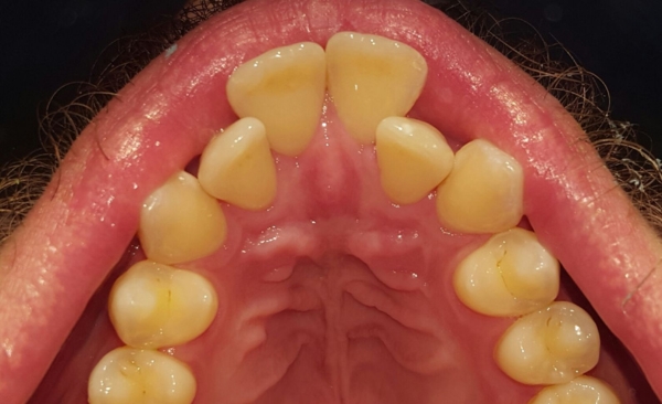 Before - Taylored Dental Care