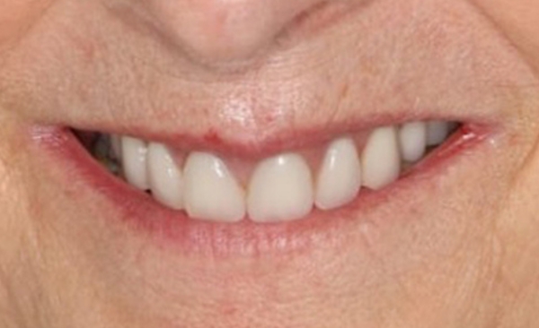 After - Taylored Dental Care