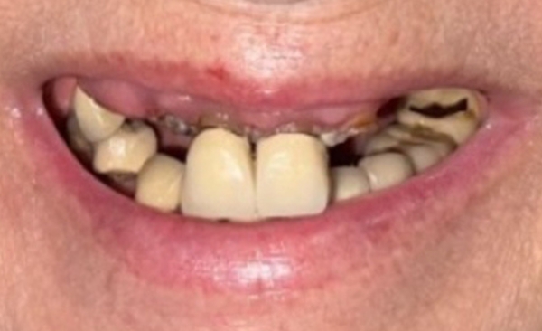 Before - Taylored Dental Care