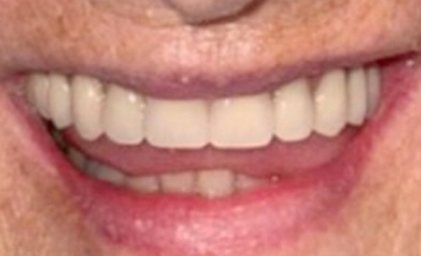After - Taylored Dental Care