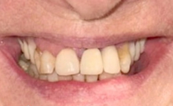 Before - Taylored Dental Care
