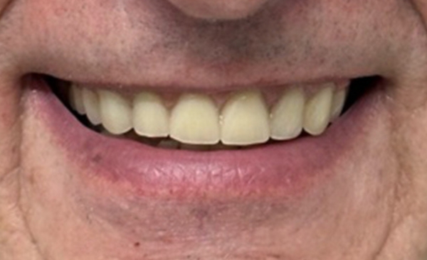 After - Taylored Dental Care