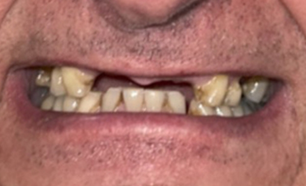 Before - Taylored Dental Care