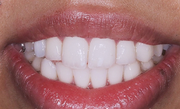 After - Taylored Dental Care