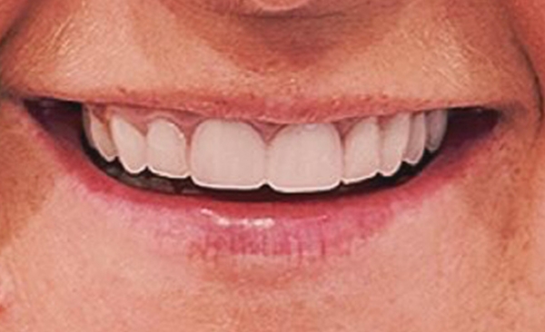After - Taylored Dental Care