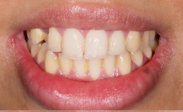 Before - Taylored Dental Care