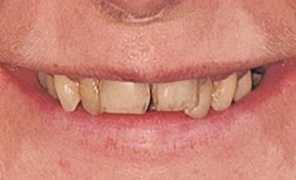 Before - Taylored Dental Care
