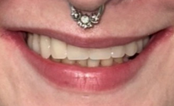 After - Taylored Dental Care