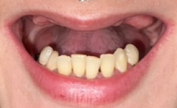Before - Taylored Dental Care
