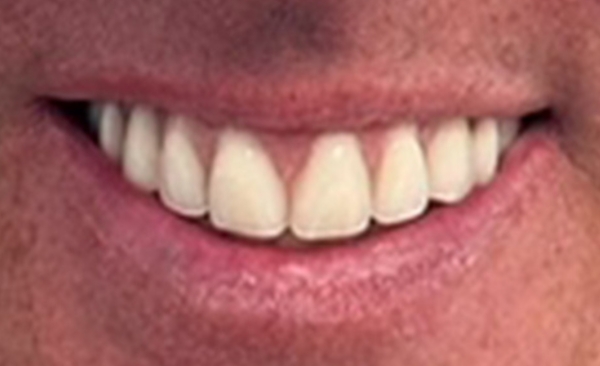 After - Taylored Dental Care
