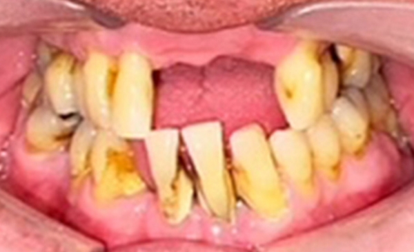 Before - Taylored Dental Care