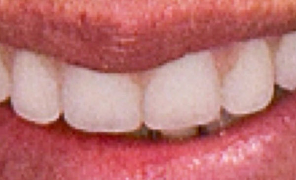After - Taylored Dental Care