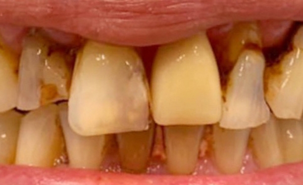 Before - Taylored Dental Care