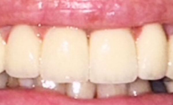 After - Taylored Dental Care