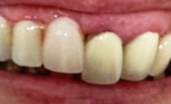 Before - Taylored Dental Care