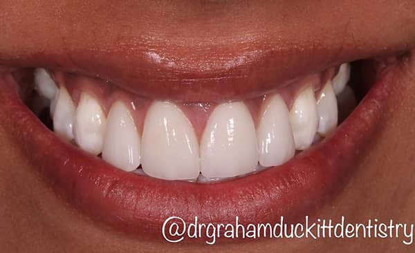 After - Taylored Dental Care