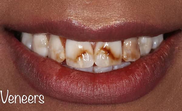 Before - Taylored Dental Care