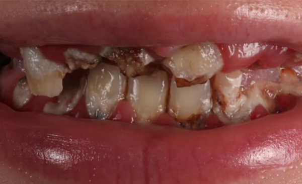 Before - Taylored Dental Care