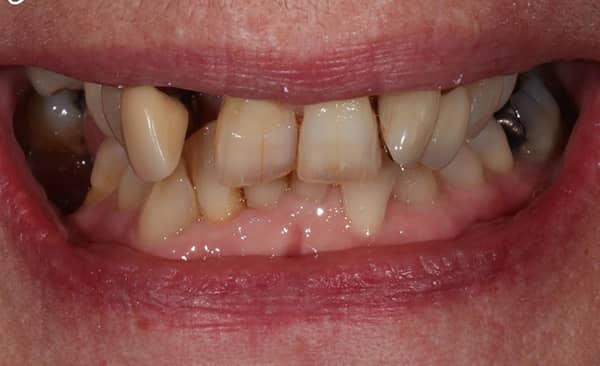 Before - Taylored Dental Care