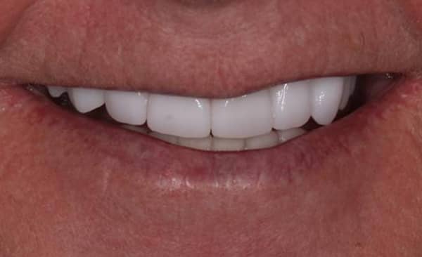 After - Taylored Dental Care