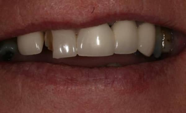 Before - Taylored Dental Care