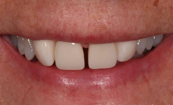 After - Taylored Dental Care