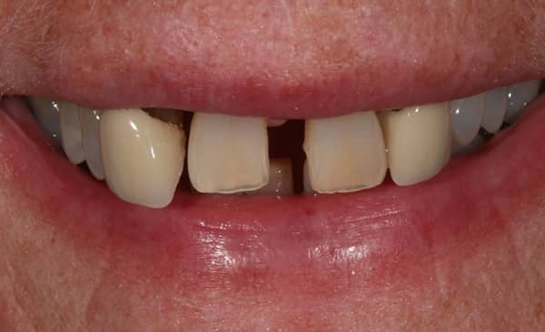 Before - Taylored Dental Care